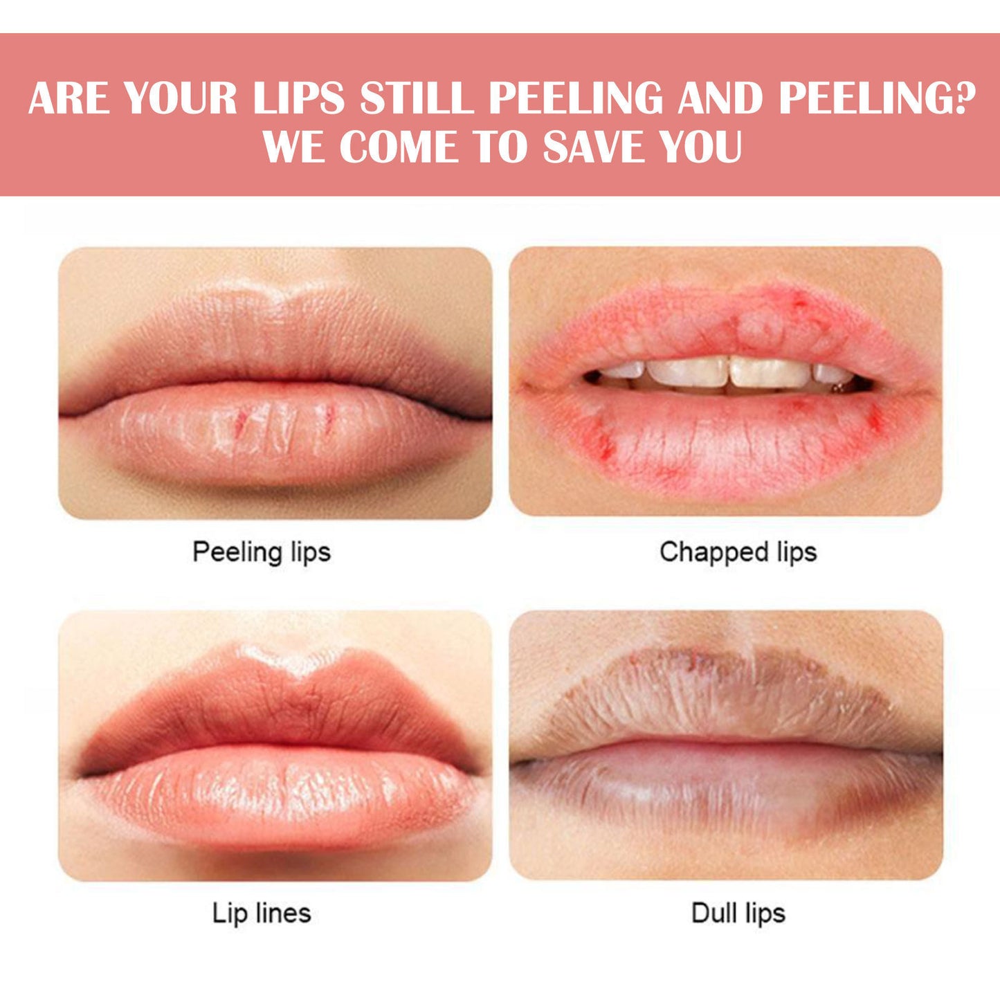 Hydrating Watermelon Lip Balm – Smooth, Shine & Protect